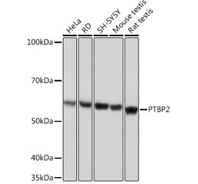 Western Blot - Anti-PTBP2 Antibody [ARC1798] (A307130) - Antibodies.com