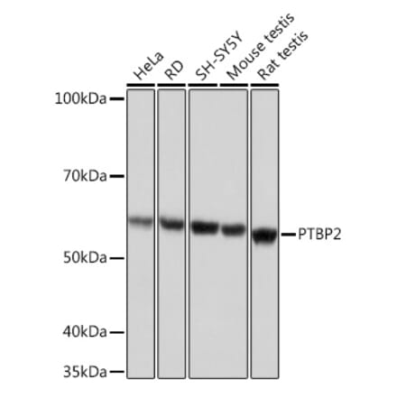 Western Blot - Anti-PTBP2 Antibody [ARC1798] (A307130) - Antibodies.com