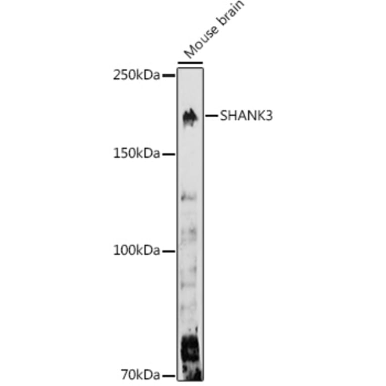 Western Blot - Anti-SHANK3 Antibody (A307131) - Antibodies.com