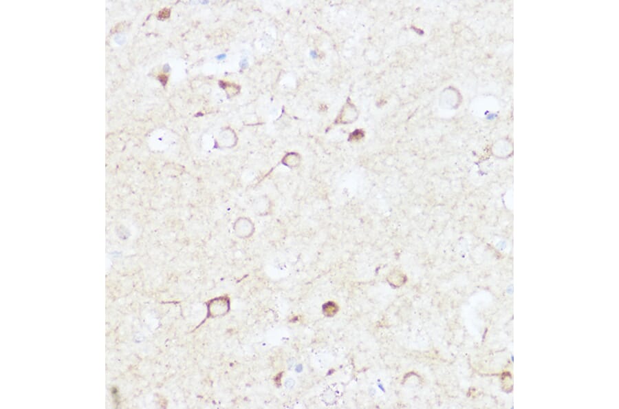 Immunohistochemistry - Anti-SHANK3 Antibody (A307131) - Antibodies.com
