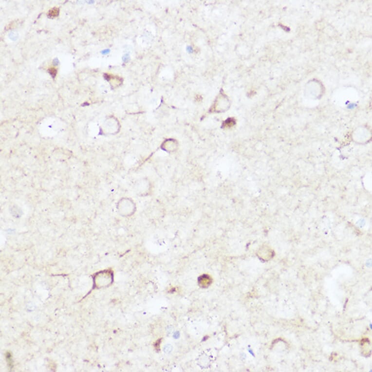 Immunohistochemistry - Anti-SHANK3 Antibody (A307131) - Antibodies.com