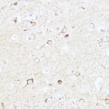 Immunohistochemistry - Anti-SHANK3 Antibody (A307131) - Antibodies.com