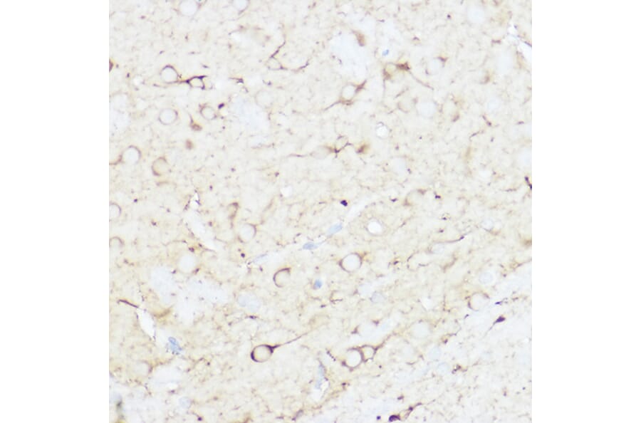 Immunohistochemistry - Anti-SHANK3 Antibody (A307131) - Antibodies.com