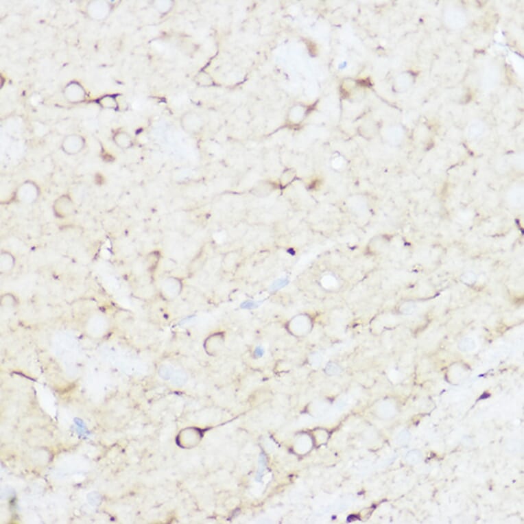 Immunohistochemistry - Anti-SHANK3 Antibody (A307131) - Antibodies.com
