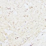 Immunohistochemistry - Anti-SHANK3 Antibody (A307131) - Antibodies.com