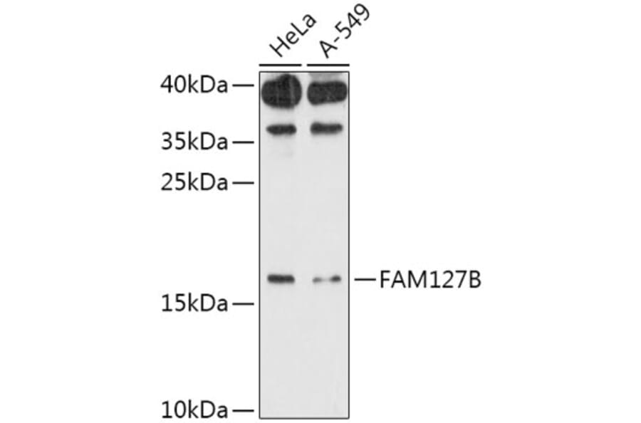 Western Blot - Anti-RTL8A Antibody (A307132) - Antibodies.com
