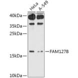 Western Blot - Anti-RTL8A Antibody (A307132) - Antibodies.com