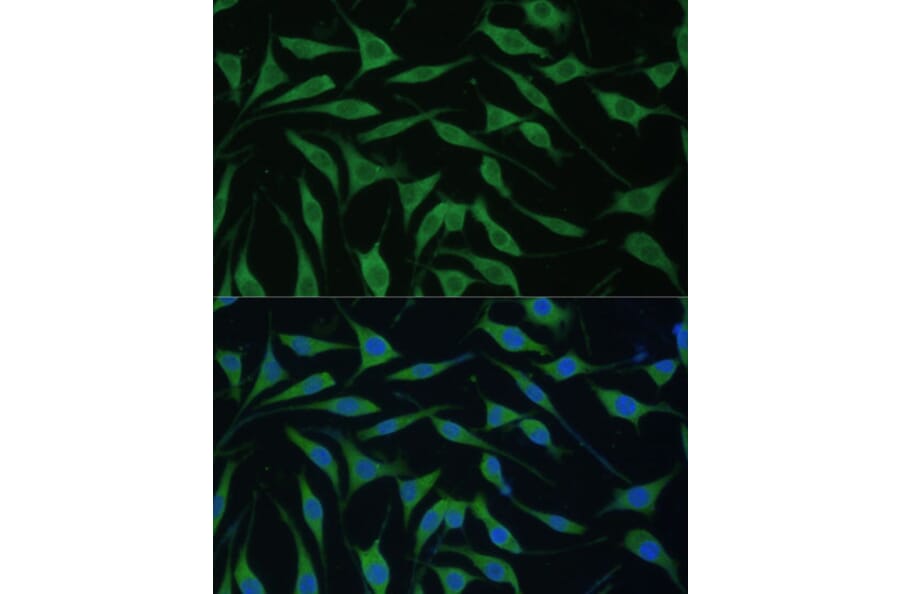 Immunofluorescence - Anti-RTL8A Antibody (A307132) - Antibodies.com