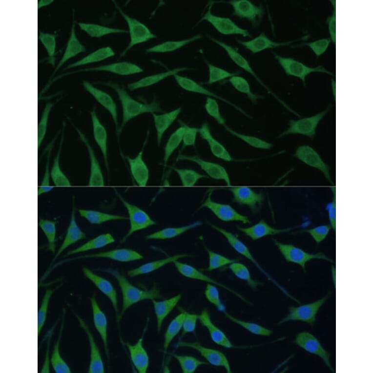 Immunofluorescence - Anti-RTL8A Antibody (A307132) - Antibodies.com