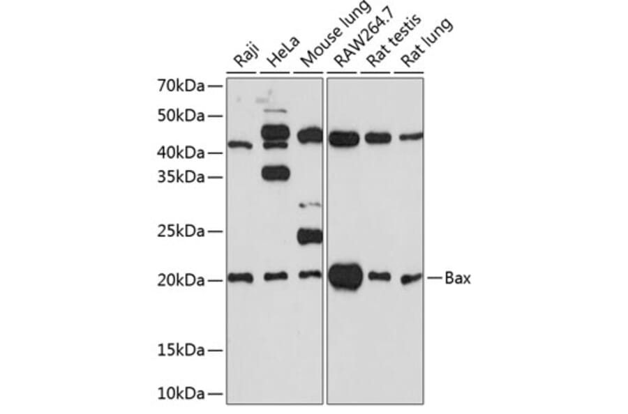 Western Blot - Anti-Bax Antibody [ARC0164] (A307133) - Antibodies.com