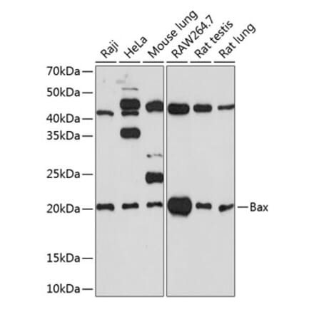 Western Blot - Anti-Bax Antibody [ARC0164] (A307133) - Antibodies.com