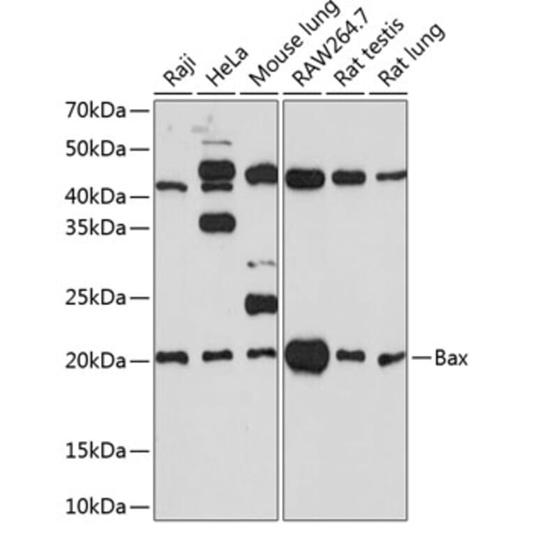 Western Blot - Anti-Bax Antibody [ARC0164] (A307133) - Antibodies.com
