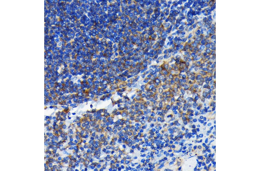 Immunohistochemistry - Anti-Bax Antibody [ARC0164] (A307133) - Antibodies.com