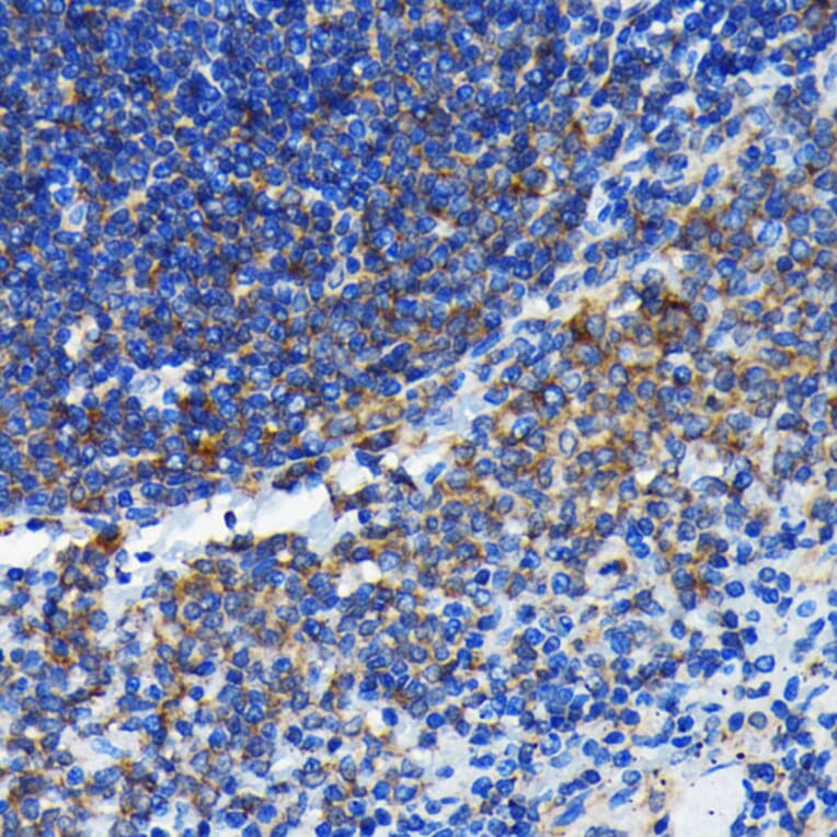 Immunohistochemistry - Anti-Bax Antibody [ARC0164] (A307133) - Antibodies.com