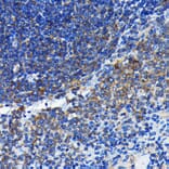 Immunohistochemistry - Anti-Bax Antibody [ARC0164] (A307133) - Antibodies.com