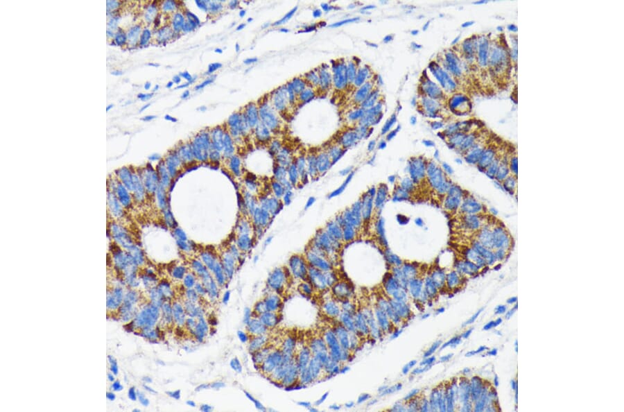 Immunohistochemistry - Anti-Bax Antibody [ARC0164] (A307133) - Antibodies.com
