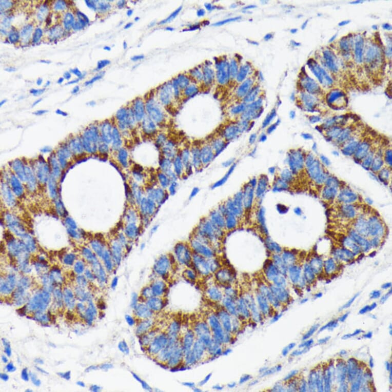 Immunohistochemistry - Anti-Bax Antibody [ARC0164] (A307133) - Antibodies.com