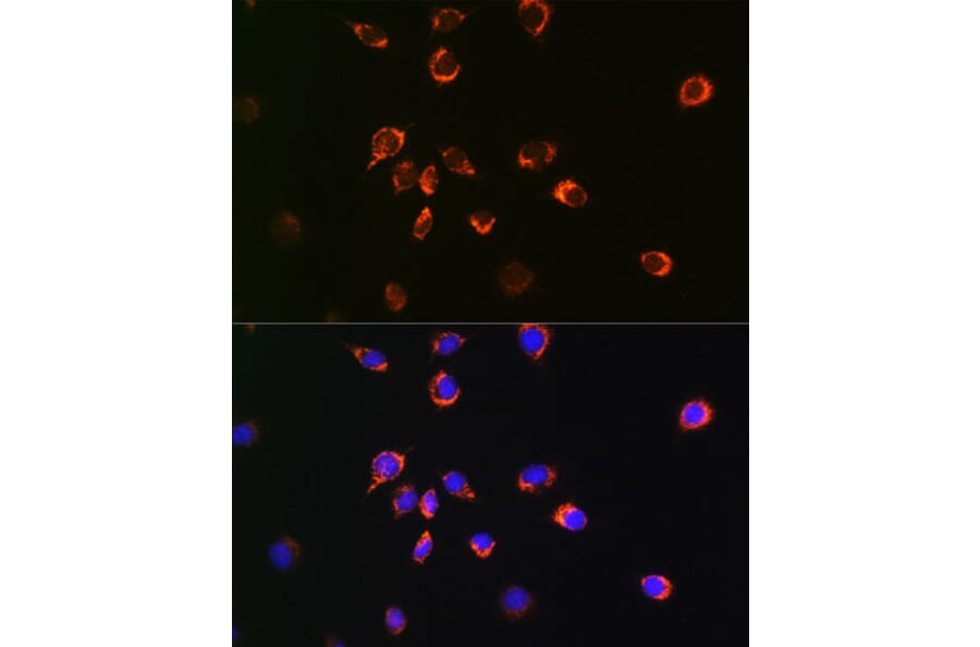 Immunofluorescence - Anti-Bax Antibody [ARC0164] (A307133) - Antibodies.com
