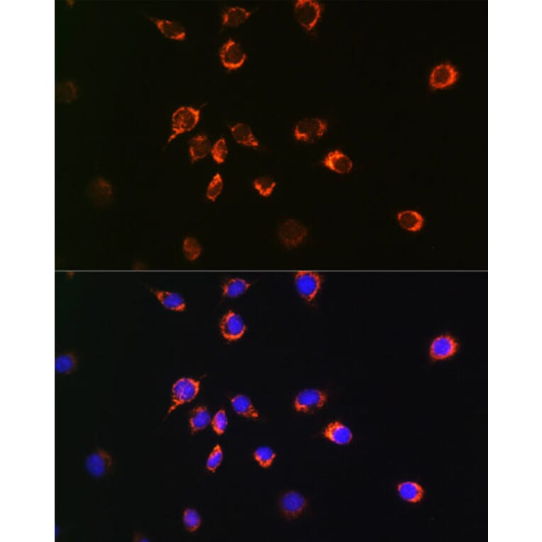 Immunofluorescence - Anti-Bax Antibody [ARC0164] (A307133) - Antibodies.com