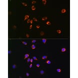 Immunofluorescence - Anti-Bax Antibody [ARC0164] (A307133) - Antibodies.com
