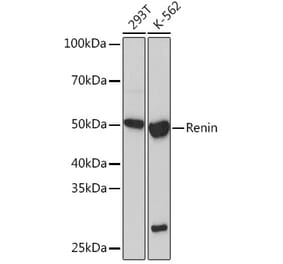 Western Blot - Anti-Renin Antibody [ARC1149] (A307134) - Antibodies.com