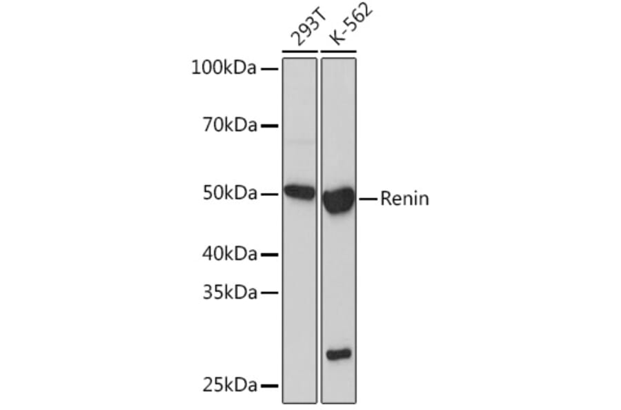 Western Blot - Anti-Renin Antibody [ARC1149] (A307134) - Antibodies.com