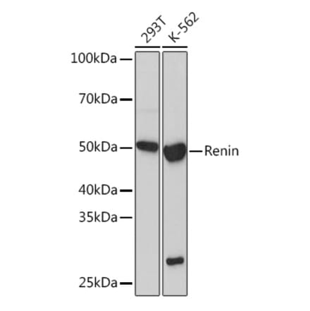 Western Blot - Anti-Renin Antibody [ARC1149] (A307134) - Antibodies.com
