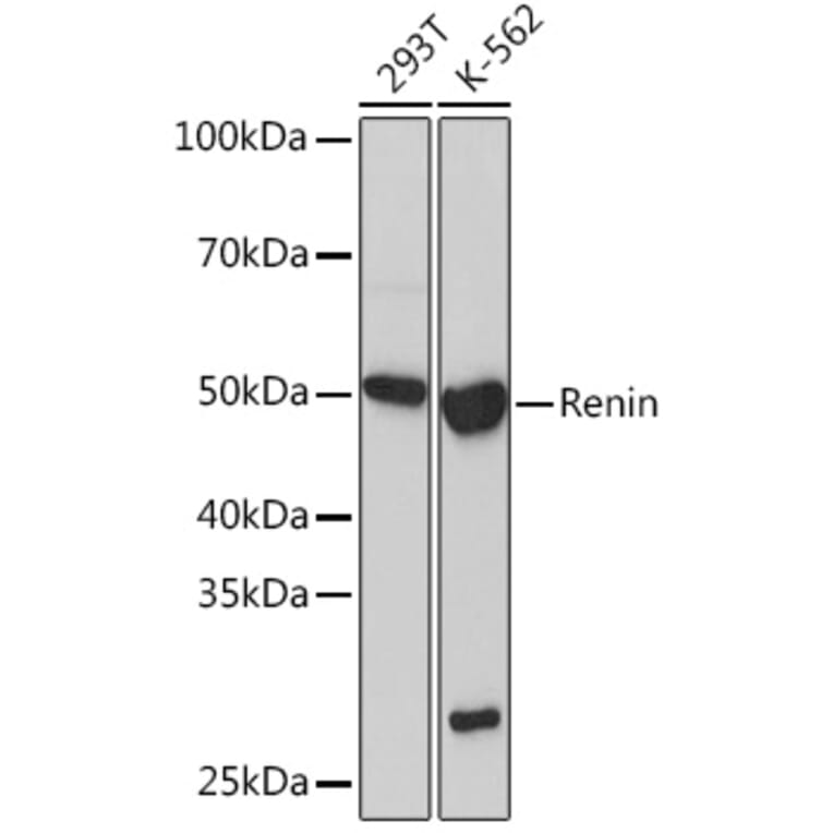Western Blot - Anti-Renin Antibody [ARC1149] (A307134) - Antibodies.com