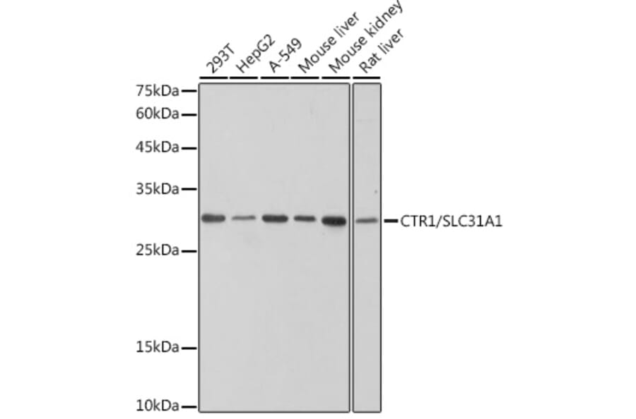 Western Blot - Anti-SLC31A1/CTR1 Antibody [ARC2537] (A307135) - Antibodies.com