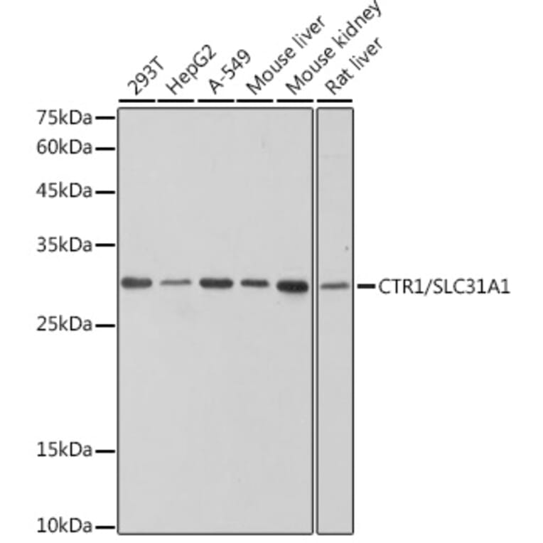 Western Blot - Anti-SLC31A1/CTR1 Antibody [ARC2537] (A307135) - Antibodies.com
