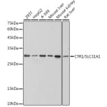Western Blot - Anti-SLC31A1/CTR1 Antibody [ARC2537] (A307135) - Antibodies.com