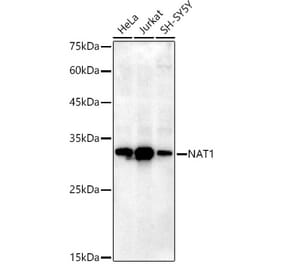 Western Blot - Anti-NAT1 Antibody [ARC2858] (A307136) - Antibodies.com