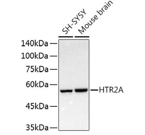 Western Blot - Anti-5HT2A Receptor Antibody (A307137) - Antibodies.com