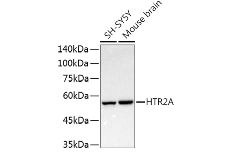 Western Blot - Anti-5HT2A Receptor Antibody (A307137) - Antibodies.com