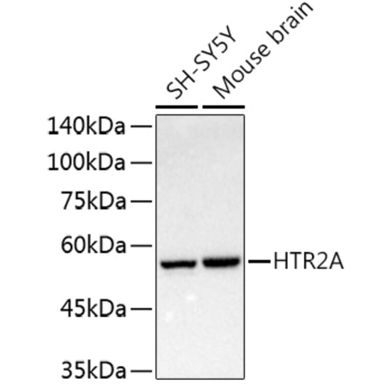 Western Blot - Anti-5HT2A Receptor Antibody (A307137) - Antibodies.com