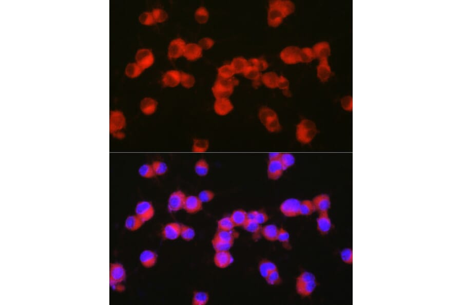 Immunofluorescence - Anti-5HT2A Receptor Antibody (A307137) - Antibodies.com