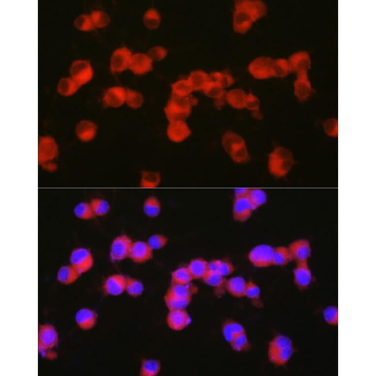 Immunofluorescence - Anti-5HT2A Receptor Antibody (A307137) - Antibodies.com