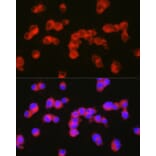 Immunofluorescence - Anti-5HT2A Receptor Antibody (A307137) - Antibodies.com
