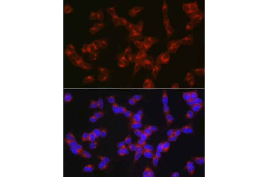 Immunofluorescence - Anti-5HT2A Receptor Antibody (A307137) - Antibodies.com