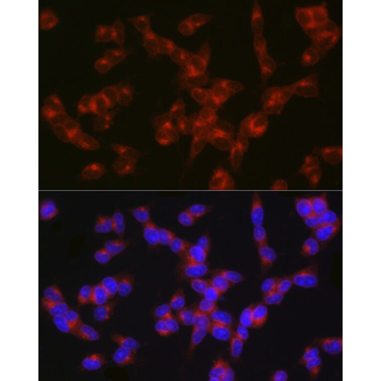 Immunofluorescence - Anti-5HT2A Receptor Antibody (A307137) - Antibodies.com