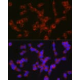 Immunofluorescence - Anti-5HT2A Receptor Antibody (A307137) - Antibodies.com