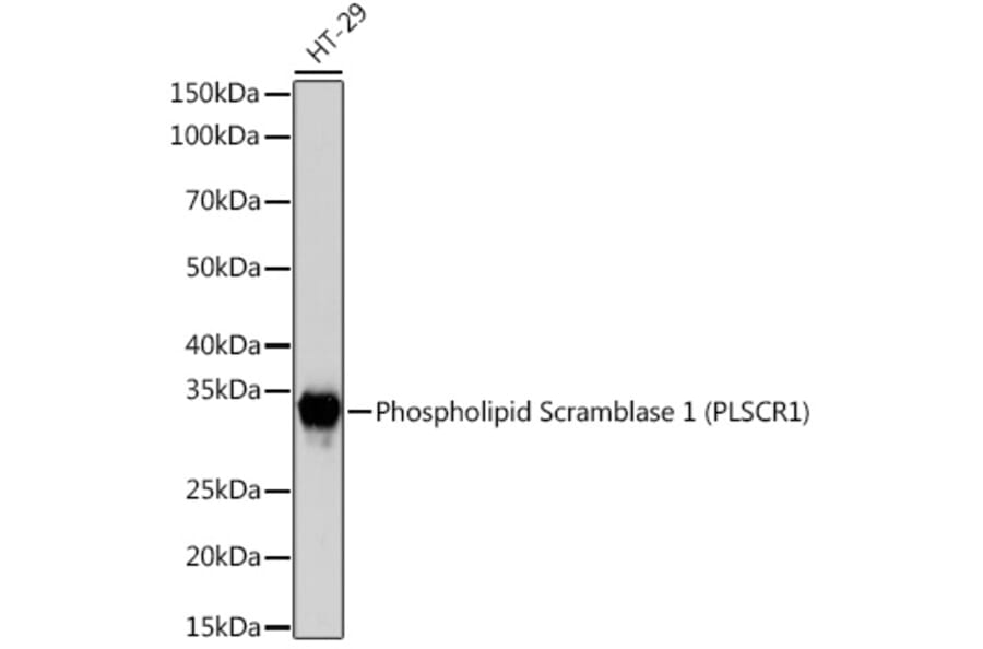 Western Blot - Anti-Scramblase 1 Antibody [ARC2028] (A307139) - Antibodies.com
