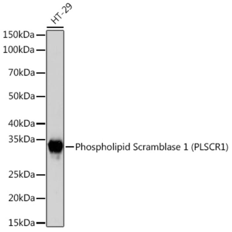 Western Blot - Anti-Scramblase 1 Antibody [ARC2028] (A307139) - Antibodies.com