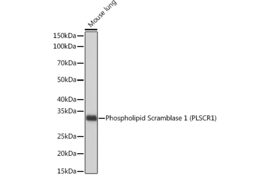 Western Blot - Anti-Scramblase 1 Antibody [ARC2028] (A307139) - Antibodies.com
