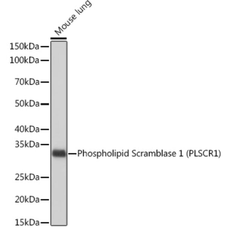 Western Blot - Anti-Scramblase 1 Antibody [ARC2028] (A307139) - Antibodies.com