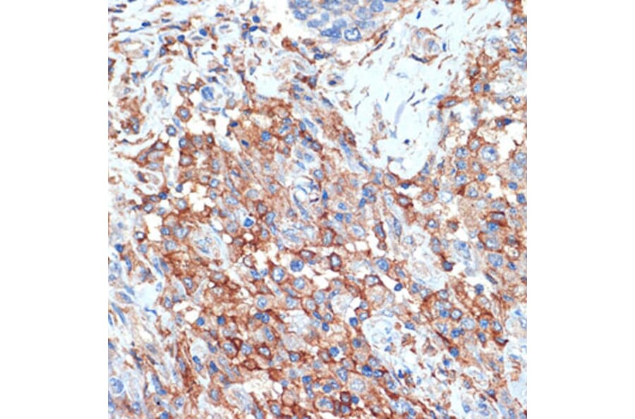 Immunohistochemistry - Anti-Scramblase 1 Antibody [ARC2028] (A307139) - Antibodies.com