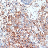 Immunohistochemistry - Anti-Scramblase 1 Antibody [ARC2028] (A307139) - Antibodies.com