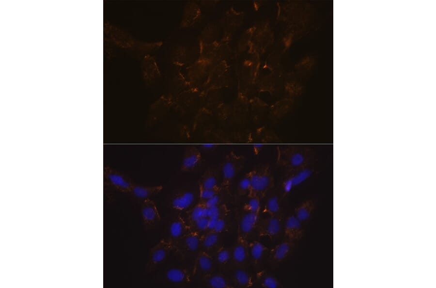 Immunofluorescence - Anti-Scramblase 1 Antibody [ARC2028] (A307139) - Antibodies.com