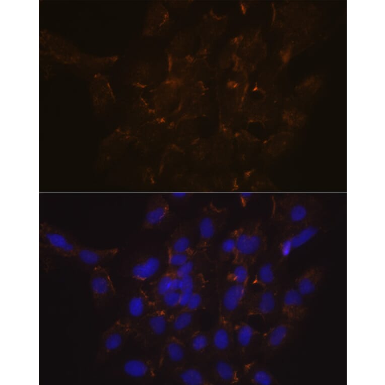Immunofluorescence - Anti-Scramblase 1 Antibody [ARC2028] (A307139) - Antibodies.com