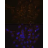Immunofluorescence - Anti-Scramblase 1 Antibody [ARC2028] (A307139) - Antibodies.com
